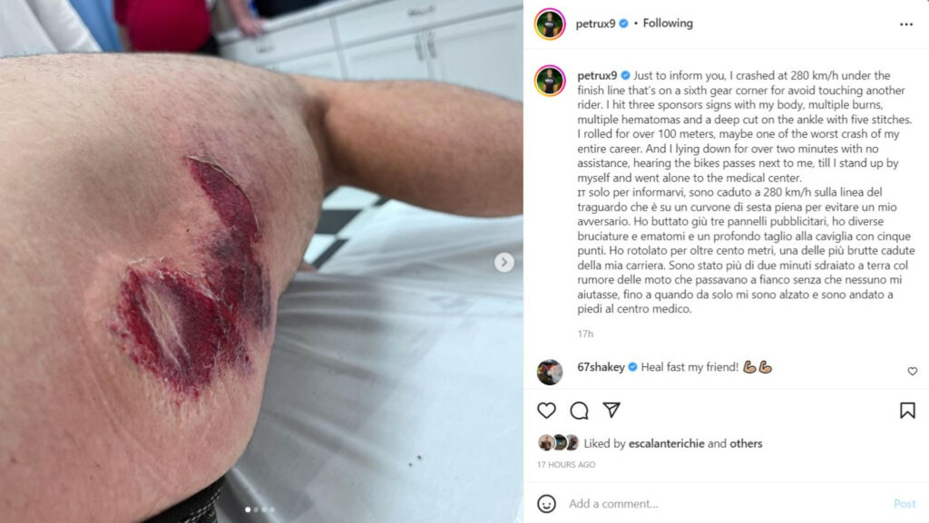 A screenshot of Danilo Petrucci's Instagram post showing some of his injuries. 