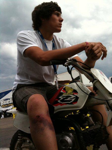 A Young Racer Wandered Back Into The Woods On His Minibike At Mid-Ohio, Where He Was Rammed And Left Where He Fell By A Spectator In A Side-by-side UTV